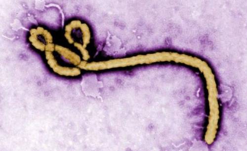 Brasil tem primeiro caso de suspeita de ebola; autoridades investigam caso